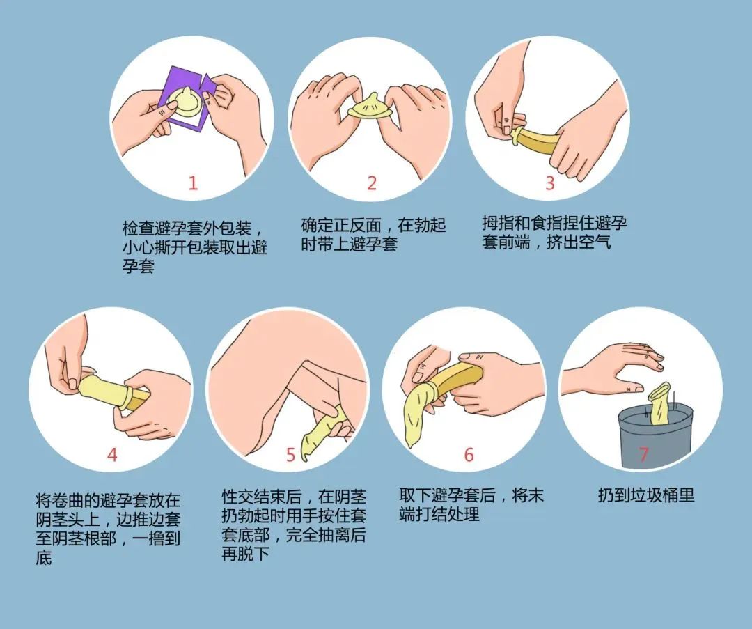年輕人成艾滋病重災區(qū)，正確戴套很有必要.jpg
